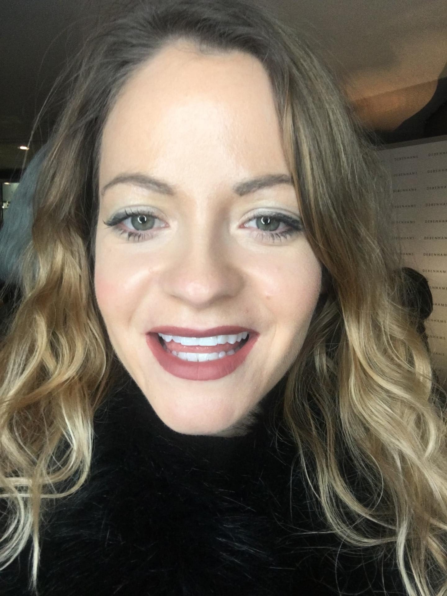 Philips Zoom! Teeth Whitening Treatment - Photo Tutorial by Jamie 4